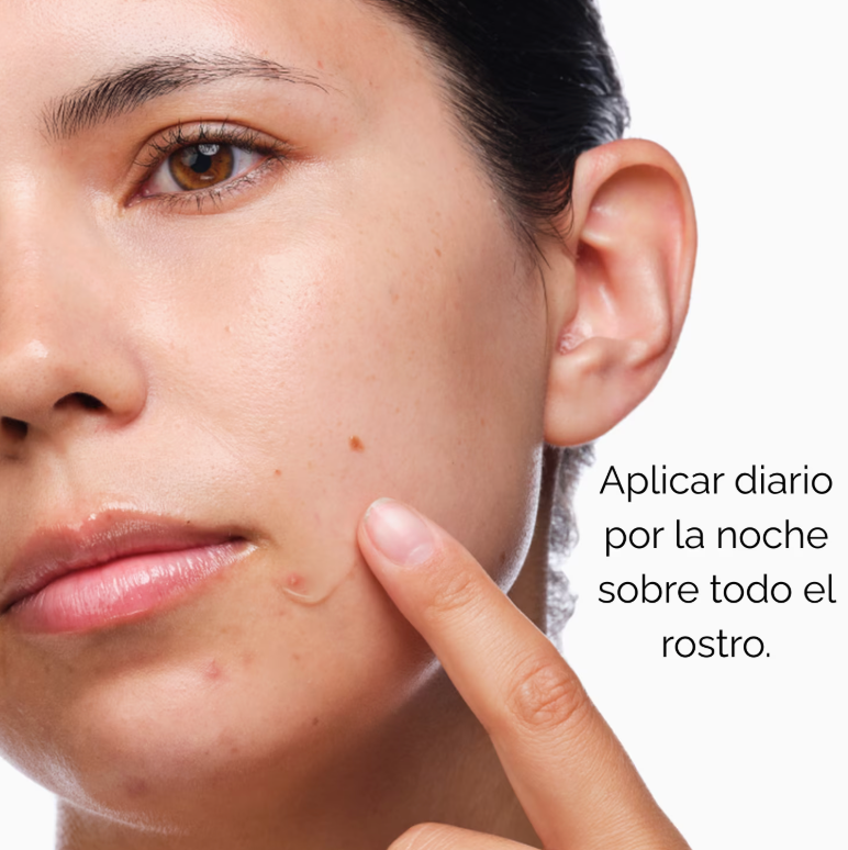 The Ordinary Clear Set pieles con tendencia acne (Pre-orden)